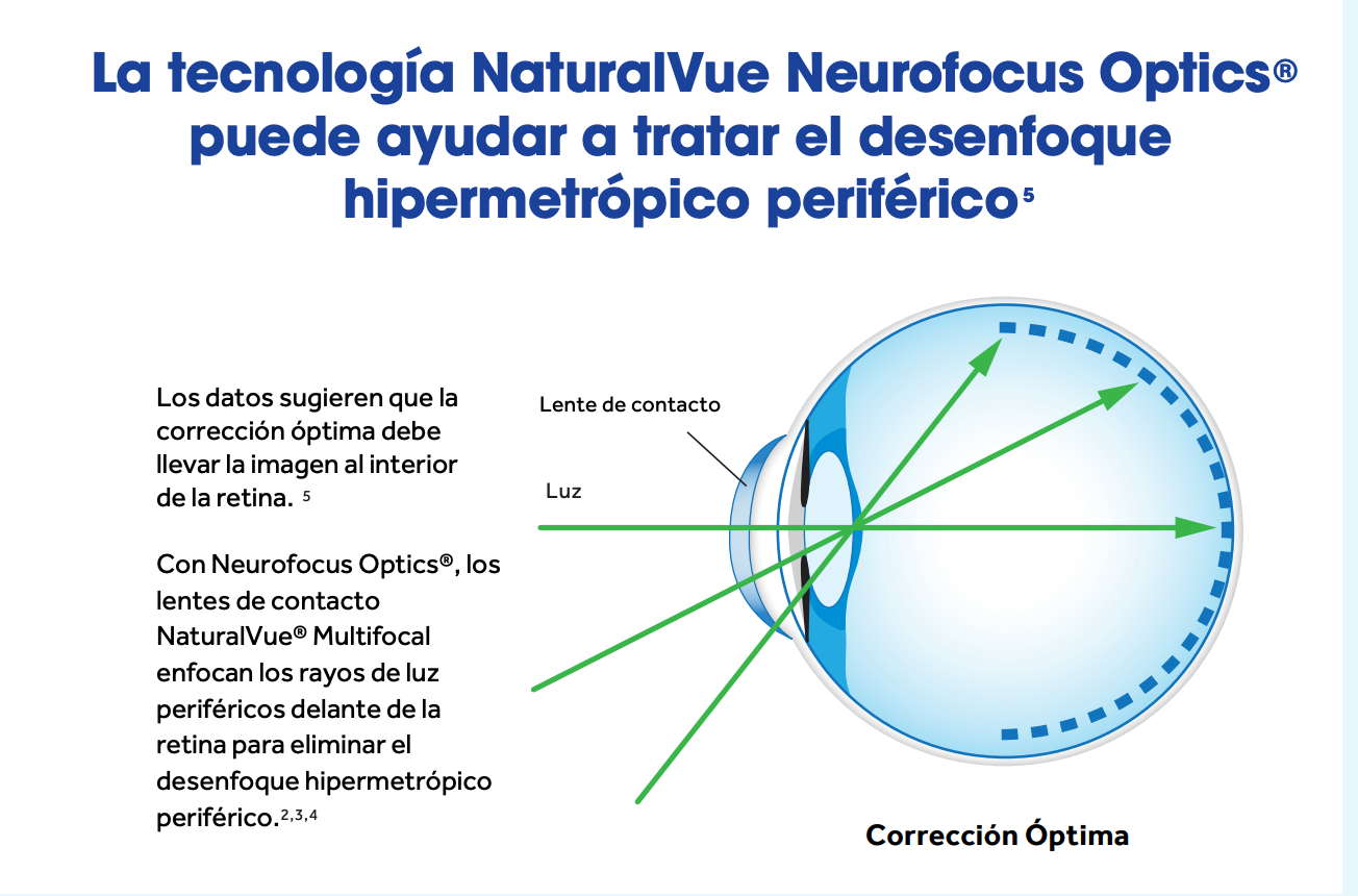 NaturalVue Miopía